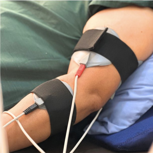 EMS electrodes applied to a patient&rsquo;s knee for targeted muscle activation